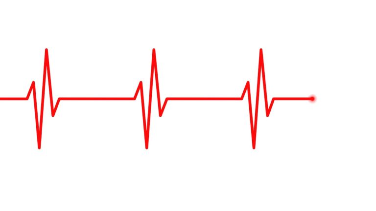 electrocardiogram, ecg, heartbeat-5090352.jpg